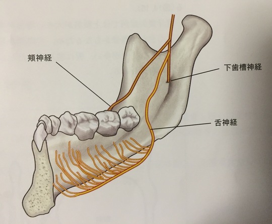 インプラント手術時の偶発症 | 習志野市の歯科スマイルドクター - 医療